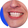Florian Hesselbarth Florian Hesselbarth